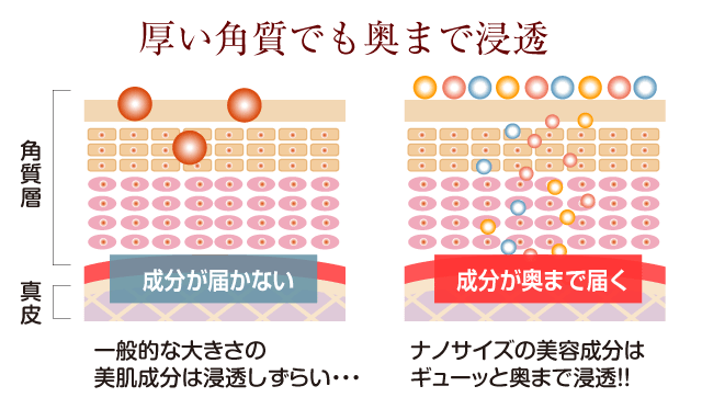厚い角質でもナノサイズで奥まで浸透